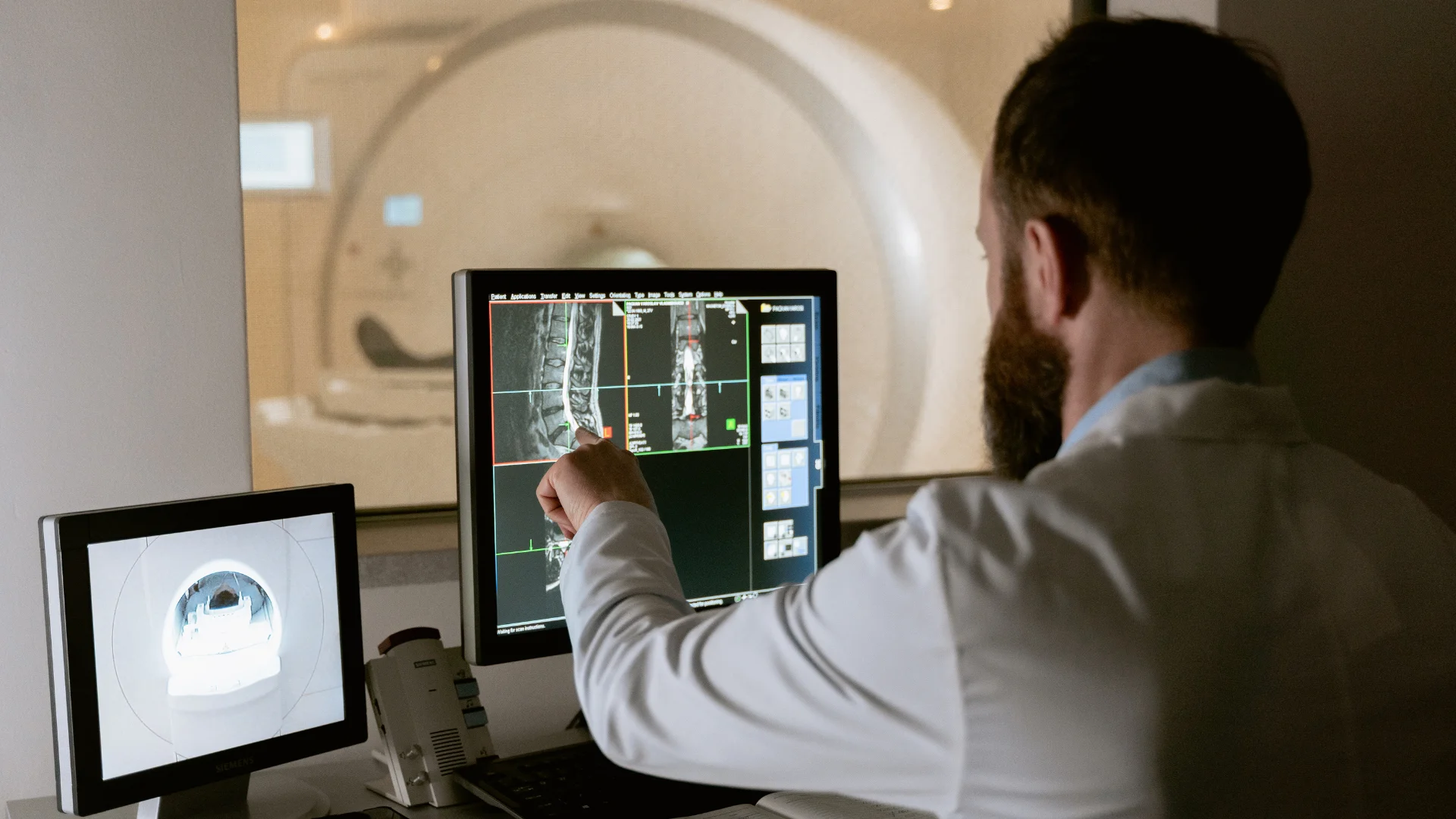 resonancia magnética de cerebro normal: doctor revisando una resosancia